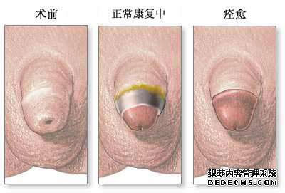 ���Ը����Ƥ�������з���