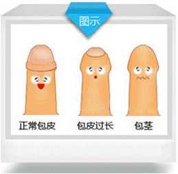 包皮多长需要切?你需要割包皮吗?